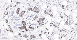 BRG1 Antibody in Immunohistochemistry (Paraffin) (IHC (P))