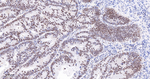 BRG1 Antibody in Immunohistochemistry (Paraffin) (IHC (P))
