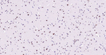 BRG1 Antibody in Immunohistochemistry (Paraffin) (IHC (P))
