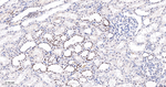 BRG1 Antibody in Immunohistochemistry (Paraffin) (IHC (P))