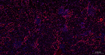 BRG1 Antibody in Immunohistochemistry (Paraffin) (IHC (P))