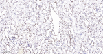 BRG1 Antibody in Immunohistochemistry (Paraffin) (IHC (P))