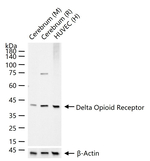 OPRD1 Recombinant Rabbit Monoclonal Antibody (6F2)