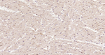 CD36 Antibody in Immunohistochemistry (Paraffin) (IHC (P))