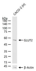 GLUT2 Antibody in Western Blot (WB)