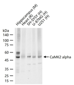 CaMKII alpha Antibody in Western Blot (WB)