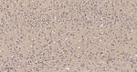 MKK7 Antibody in Immunohistochemistry (Paraffin) (IHC (P))