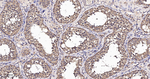 MKK7 Antibody in Immunohistochemistry (Paraffin) (IHC (P))