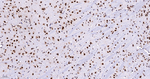 CDC5L Antibody in Immunohistochemistry (Paraffin) (IHC (P))