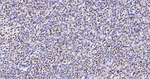 CDC5L Recombinant Rabbit Monoclonal Antibody (7H3)