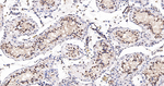 CDC5L Antibody in Immunohistochemistry (Paraffin) (IHC (P))