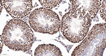 CDC5L Antibody in Immunohistochemistry (Paraffin) (IHC (P))