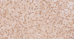 HSP105 Antibody in Immunohistochemistry (Paraffin) (IHC (P))