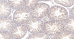 HSP105 Antibody in Immunohistochemistry (Paraffin) (IHC (P))