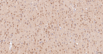 HSP105 Antibody in Immunohistochemistry (Paraffin) (IHC (P))