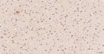 HSP105 Antibody in Immunohistochemistry (Paraffin) (IHC (P))