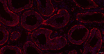 HSP105 Antibody in Immunohistochemistry (Paraffin) (IHC (P))