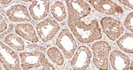 HSP105 Antibody in Immunohistochemistry (Paraffin) (IHC (P))