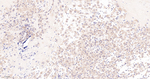 Caspase 2 Recombinant Rabbit Monoclonal Antibody (9E3)