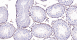 Caspase 2 Antibody in Immunohistochemistry (Paraffin) (IHC (P))