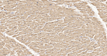HSP20 Antibody in Immunohistochemistry (Paraffin) (IHC (P))