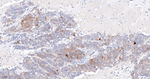 HSP20 Antibody in Immunohistochemistry (Paraffin) (IHC (P))
