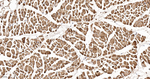 HSP20 Antibody in Immunohistochemistry (Paraffin) (IHC (P))