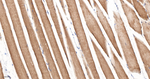 HSP20 Antibody in Immunohistochemistry (Paraffin) (IHC (P))
