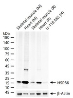 HSP20 Antibody in Western Blot (WB)
