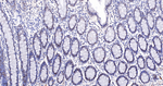 CDCA5 Antibody in Immunohistochemistry (Paraffin) (IHC (P))