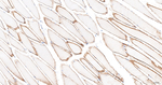 Caveolin 3 Antibody in Immunohistochemistry (Paraffin) (IHC (P))