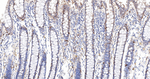 HSPA2 Recombinant Rabbit Monoclonal Antibody (9A10)