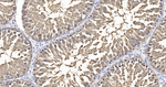 HSPA2 Antibody in Immunohistochemistry (Paraffin) (IHC (P))