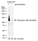 Phospho-c-Cbl (Ser669) Recombinant Rabbit Monoclonal Antibody (9A7)
