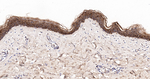 Caspase 14 Antibody in Immunohistochemistry (Paraffin) (IHC (P))