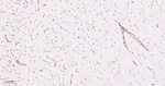 CD49e Antibody in Immunohistochemistry (Paraffin) (IHC (P))