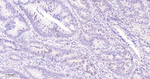 MGMT Antibody in Immunohistochemistry (Paraffin) (IHC (P))
