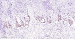 MGMT Recombinant Rabbit Monoclonal Antibody (3F8)