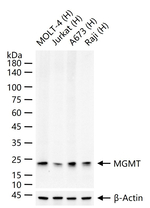 MGMT Antibody in Western Blot (WB)