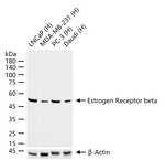 Estrogen Receptor beta Recombinant Rabbit Monoclonal Antibody (9F1)
