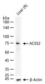 ACSS2 Antibody in Western Blot (WB)