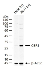 CBR1 Recombinant Rabbit Monoclonal Antibody (11G4)