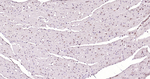 E2F1 Antibody in Immunohistochemistry (Paraffin) (IHC (P))