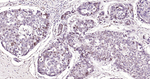 E2F1 Recombinant Rabbit Monoclonal Antibody (4D13)