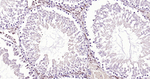 E2F1 Antibody in Immunohistochemistry (Paraffin) (IHC (P))