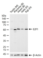 E2F1 Antibody in Western Blot (WB)
