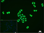 FUS Antibody in Immunocytochemistry (ICC/IF)