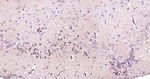 FUS Antibody in Immunohistochemistry (Paraffin) (IHC (P))