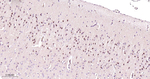 FUS Antibody in Immunohistochemistry (Paraffin) (IHC (P))