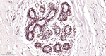 FUS Antibody in Immunohistochemistry (Paraffin) (IHC (P))